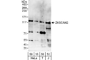 anti-Zinc Finger with KRAB and SCAN Domains 2 (ZKSCAN2) (AA 917-967) antibody