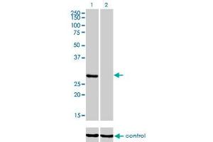 Western Blotting (WB) image for anti-Ketohexokinase (KHK) (AA 1-299) antibody (ABIN598769) (Ketohexokinase 抗体  (AA 1-299))