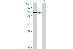 Western Blotting (WB) image for anti-Tyrosine-Protein Phosphatase Non-Receptor Type 22 (PTPN22) (AA 1-752) antibody (ABIN525622)