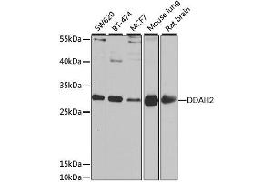 Western blot analysis of extracts of various cell lines, using DDAH2 antibody. (DDAH2 抗体  (AA 1-285))