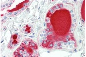 Human Thyroid: Formalin-Fixed, Paraffin-Embedded (FFPE) (HAS3 抗体  (AA 137-164))