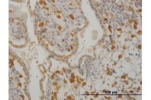 Immunoperoxidase of monoclonal antibody to HCLS1 on formalin-fixed paraffin-embedded human placenta. (HCLS1 抗体  (AA 266-355))