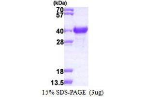 SDS-PAGE (SDS) image for Nascent Polypeptide Associated Complex alpha 1 (NACa1) (AA 1-215) protein (His tag) (ABIN667605) (NACA Protein (AA 1-215) (His tag))