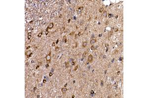 Immunohistochemistry (IHC) image for anti-Dynein, Cytoplasmic 1, Light Intermediate Chain 2 (DYNC1LI2) antibody (ABIN7266863)