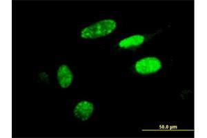 Immunofluorescence of monoclonal antibody to HIC1 on HeLa cell. (HIC1 抗体  (AA 396-453))
