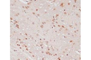 Immunohistochemistry (Paraffin-embedded Sections) (IHC (p)) image for anti-phosphoprotein Enriched in Astrocytes 15 (PEA15) (pSer104) antibody (ABIN7265284)