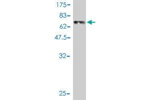 Western Blot detection against Immunogen (67. (Renin 抗体  (AA 24-406))