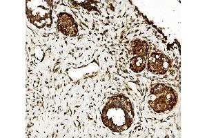 IHC analysis of CLPB using anti-CLPB antibody (ABIN7601732). (CLPB 抗体  (AA 438-707))