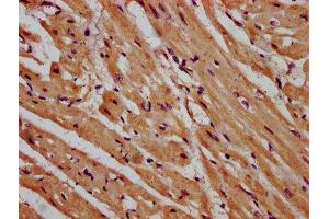 IHC image of ABIN7158901 diluted at 1:600 and staining in paraffin-embedded human heart tissue performed on a Leica BondTM system.