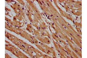 IHC image of ABIN7158901 diluted at 1:600 and staining in paraffin-embedded human heart tissue performed on a Leica BondTM system. (MPP3 抗体  (AA 301-432))