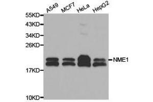 Western Blotting (WB) image for anti-Non-Metastatic Cells 1, Protein (NM23A) Expressed in (NME1) (C-Term) antibody (ABIN1873911) (NME1 抗体  (C-Term))