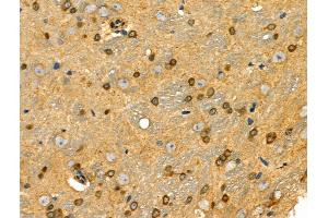 ABIN6258036 and ABIN6274198 at 1/100 staining Rat brain tissue by IHC-P. (CSRP1 抗体  (Internal Region))