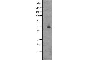 Western blot analysis of GPR83/GPR72 expression in Rat brain lysates in RIPA buffer ;developed using the ECL technique;,The lane on the left is treated with the antigen-specific peptide.