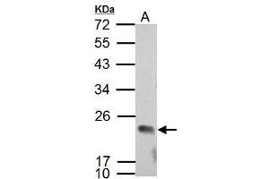 WB Image Sample (30 ug of whole cell lysate) A: NCI-H929 12% SDS PAGE antibody diluted at 1:2000 (APOBEC3C 抗体  (Center))