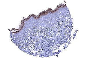 A strong KLK7 staining in the stratum granulosum and the keratinizing superficial layer of the skin (Kallikrein 7 抗体)