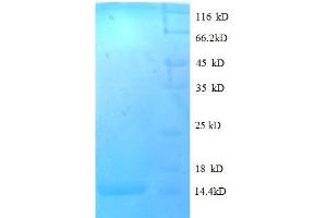 SDS-PAGE (SDS) image for Chemokine (C-C Motif) Ligand 24 (CCL24) (AA 27-119), (full length) protein (His tag) (ABIN1095507) (CCL24 Protein (AA 27-119, full length) (His tag))