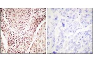 Immunohistochemistry (IHC) image for anti-Checkpoint Kinase 2 (CHEK2) (AA 361-410), (pThr387) antibody (ABIN1531263)