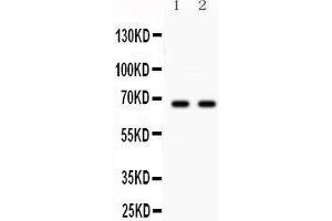 Anti- Parkin Picoband antibody, Western blotting All lanes: Anti Parkin  at 0. (Parkin 抗体  (AA 23-416))