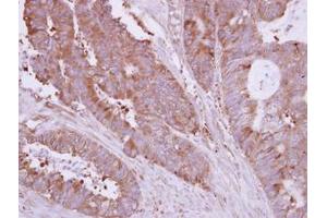 Image no. 1 for anti-Huntingtin Interacting Protein 1 Related (HIP1R) (N-Term) antibody (ABIN1494032) (HIP1R 抗体  (N-Term))