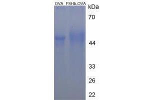 Image no. 1 for Follicle Stimulating Hormone, beta Polypeptide (FSHB) peptide (Ovalbumin) (ABIN5666180) (Follicle Stimulating Hormone, beta Polypeptide (FSHB) peptide (Ovalbumin))