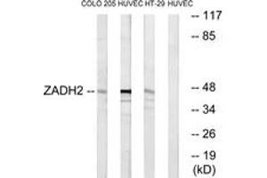 Western blot analysis of extracts from HuvEc/HT-29/COLO cells, using ZADH2 Antibody. (ZADH2 抗体  (AA 191-240))