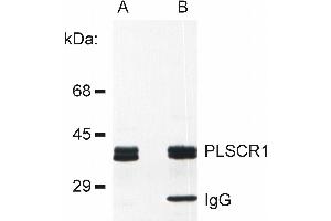 Detection of PLSCR1 in rat basophilic leukemia (RBL) cell line lysate (A) and in PLSCR1 immunoprecipitate from RBL lysate (B). (PLSCR1 抗体)