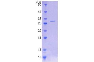 SDS-PAGE of Protein Standard from the Kit (Highly purified E. (Phenylalanine Hydroxylase ELISA 试剂盒)