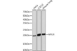 Western blot analysis of extracts of various cell lines, using MYL9 Rabbit mAb (ABIN7268755) at 1:1000 dilution. (MYL9 抗体)