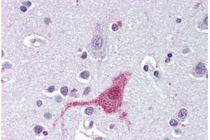Anti-EDNRB antibody  ABIN1048558 IHC staining of human brain, cortex. (EDNRB 抗体  (N-Term))