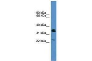 Image no. 1 for anti-Synaptoporin (SYNPR) (AA 91-140) antibody (ABIN6746589) (Synaptoporin 抗体  (AA 91-140))