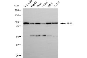 anti-Eukaryotic Translation Elongation Factor 2 (EEF2) antibody