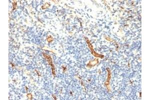 Formalin-fixed, paraffin-embedded human tonsil stained with anti-CD34 antibody (HPCA1/1171)