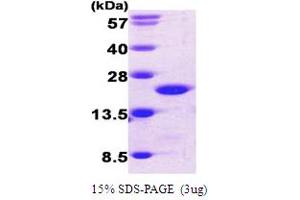 SDS-PAGE (SDS) image for Cofilin 1 (CFL1) (AA 1-166) protein (His tag) (ABIN666701) (Cofilin Protein (AA 1-166) (His tag))