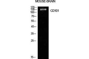 Western Blot (WB) analysis of Mouse Brain cells using CD101 Polyclonal Antibody. (CD101 抗体  (Internal Region))