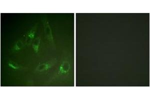 Immunofluorescence analysis of HeLa cells, using CSFR (Ab-561) Antibody. (CSF1R 抗体  (AA 531-580))