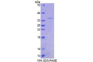 SDS-PAGE analysis of Human TSC22 Protein. (TSC22D1 蛋白)