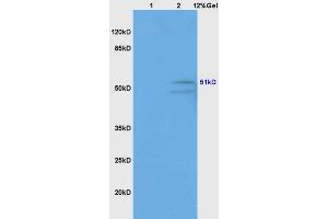 SDS-PAGE (SDS) image for anti-gamma-aminobutyric Acid (GABA) A Receptor, gamma 2 (GABRG2) (AA 41-140) antibody (ABIN754003)