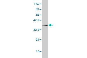 Western Blot detection against Immunogen (37. (AKAP13 抗体  (AA 1-110))