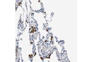 Immunohistochemical staining (Formalin-fixed paraffin-embedded sections) of human lung with XCR1 polyclonal antibody  shows strong cytoplasmic positivity in macrophages. (XCR1 抗体)