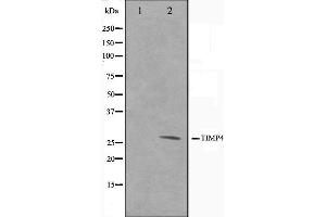 Western blot analysis on NIH-3T3 cell lysate using TIMP4 Antibody,The lane on the left is treated with the antigen-specific peptide. (TIMP4 抗体  (C-Term))