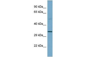 Host:  Rabbit  Target Name:  SGCB  Sample Type:  Fetal Small Intestine lysates  Antibody Dilution:  1. (SGCB 抗体  (Middle Region))
