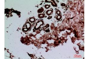 Immunohistochemistry (IHC) analysis of paraffin-embedded Human Skin, antibody was diluted at 1:100. (CEACAM1/5 抗体  (N-Term))
