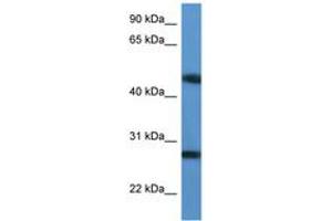 Image no. 1 for anti-TM2 Domain Containing 2 (TM2D2) (AA 97-146) antibody (ABIN6746862) (TM2D2 抗体  (AA 97-146))