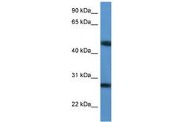 TM2D2 抗体  (AA 97-146)