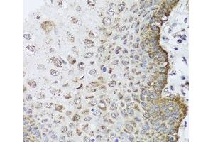 Immunohistochemistry of paraffin-embedded Human esophagus using FANCL Polyclonal Antibody at dilution of 1:100 (40x lens). (FANCL 抗体)