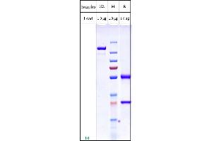 anti-Solute Carrier Family 39 (Zinc Transporter), Member 6 (SLC39A6) antibody