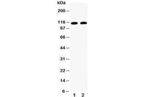 Western blot testing of Desmoglein 3 antibody and Lane 1:  A431;  2: CEM (Desmoglein 3 抗体  (AA 981-999))