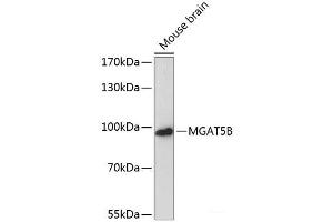 Western blot analysis of extracts of Mouse brain using MGAT5B Polyclonal Antibody at dilution of 1:3000. (MGAT5B 抗体)