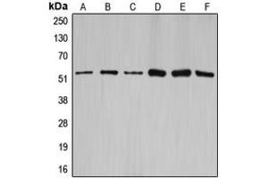 Western blot analysis of Cyclin A1/2 expression in HEK293T (A), NIH3T3 (B), rat brain (C), SW626 (D), SKOV3 (E), A2780 (F) whole cell lysates. (Cyclin-A1-2 抗体  (Center))