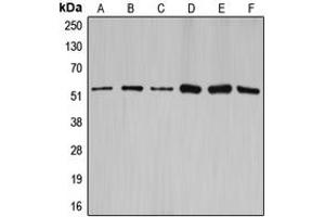 Western blot analysis of Cyclin A1/2 expression in HEK293T (A), NIH3T3 (B), rat brain (C), SW626 (D), SKOV3 (E), A2780 (F) whole cell lysates.